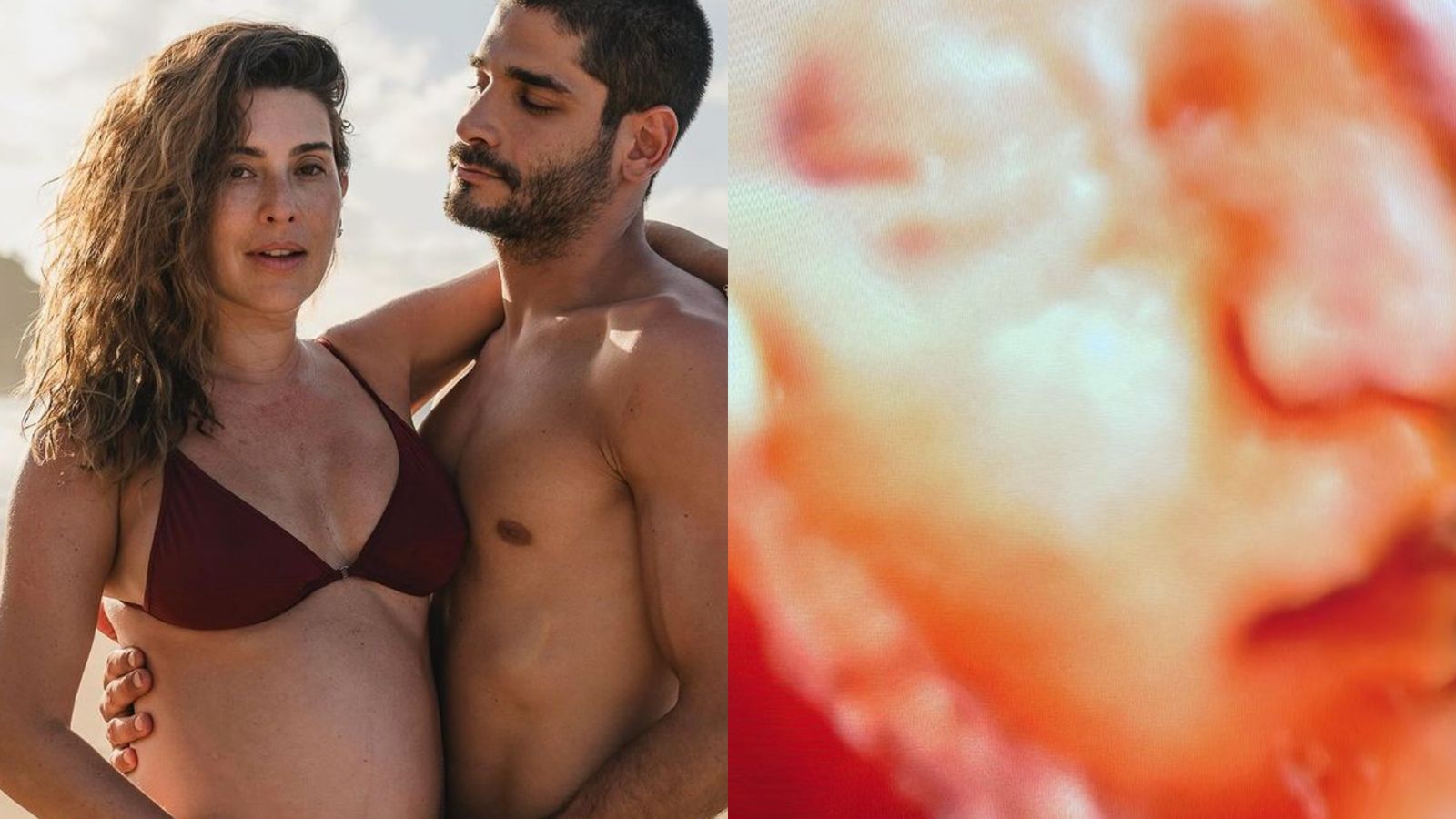 Como é o rostinho de Pilar? Noivo de Fernanda Paes Leme encanta com ultrassom