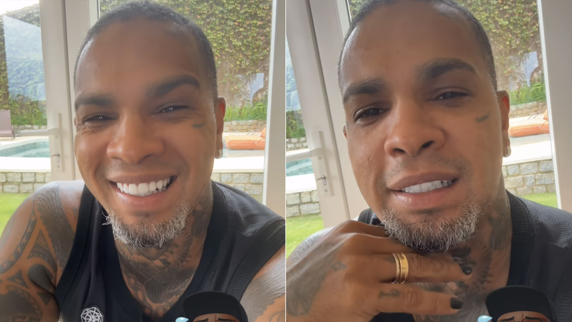 Botox? Rodriguinho revela se mexeu no rosto após o BBB 24