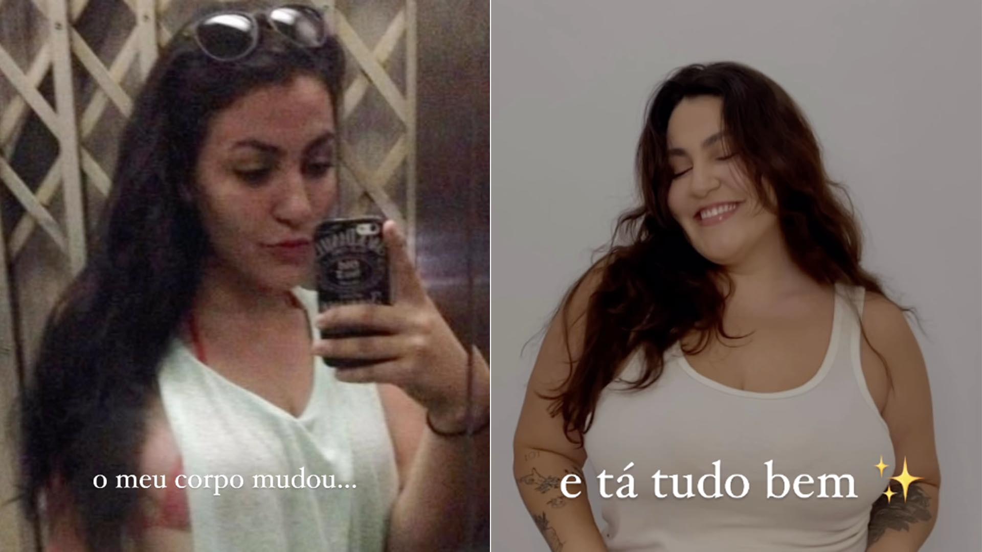 Filha de Gerson Brenner mostra fotos de antes e depois: ‘Diferente’