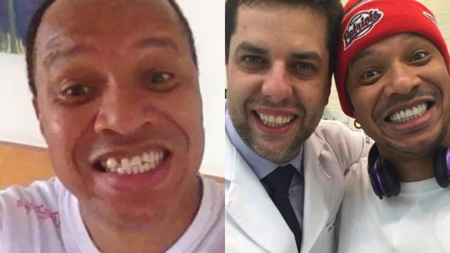 Dentista das celebridades relembra transformação feita em Anderson Leonardo: ‘Ele sorria com a alma’