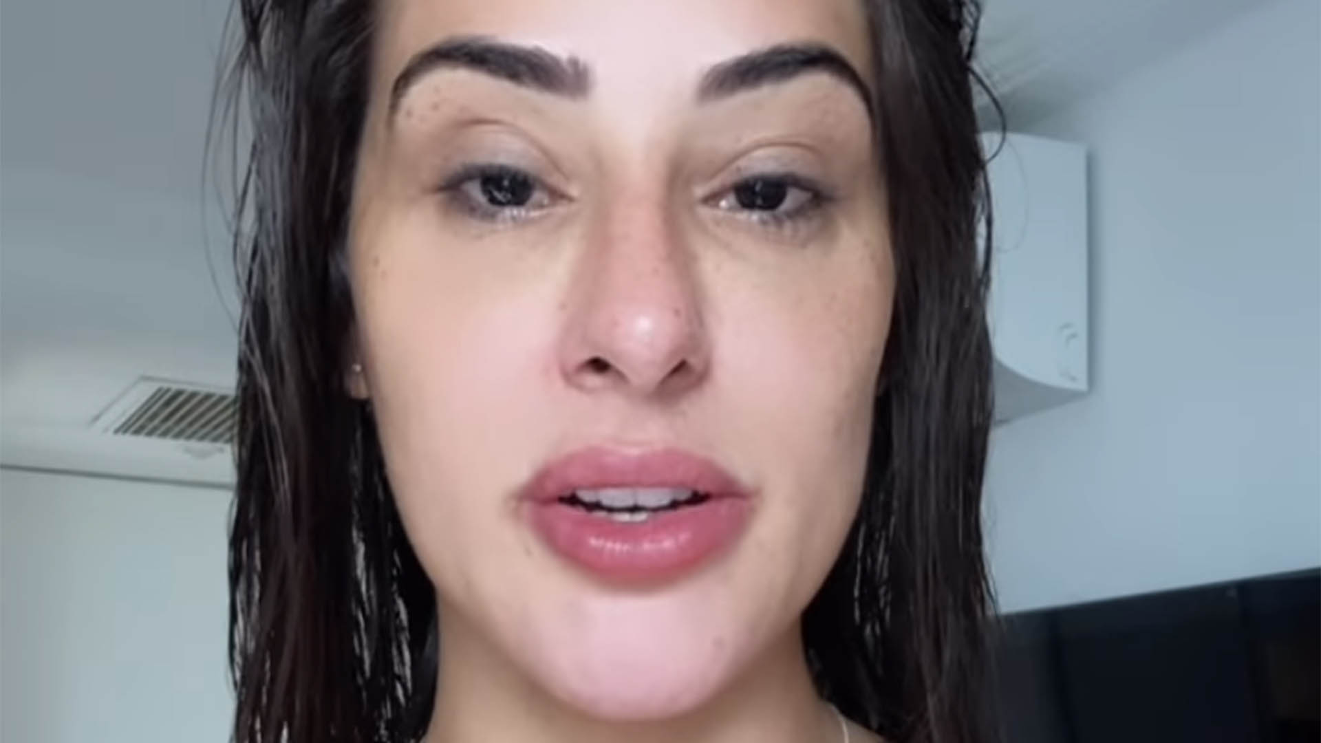 Ex-BBB Anny aparece com a boca inchada e explica o que aconteceu