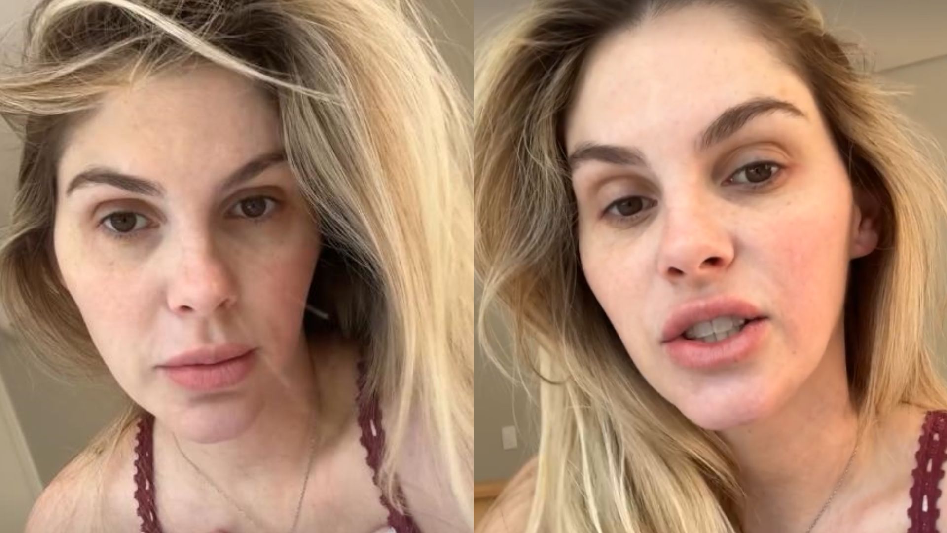Bárbara Evans revela que fará procedimentos estéticos: ‘Está marcado’