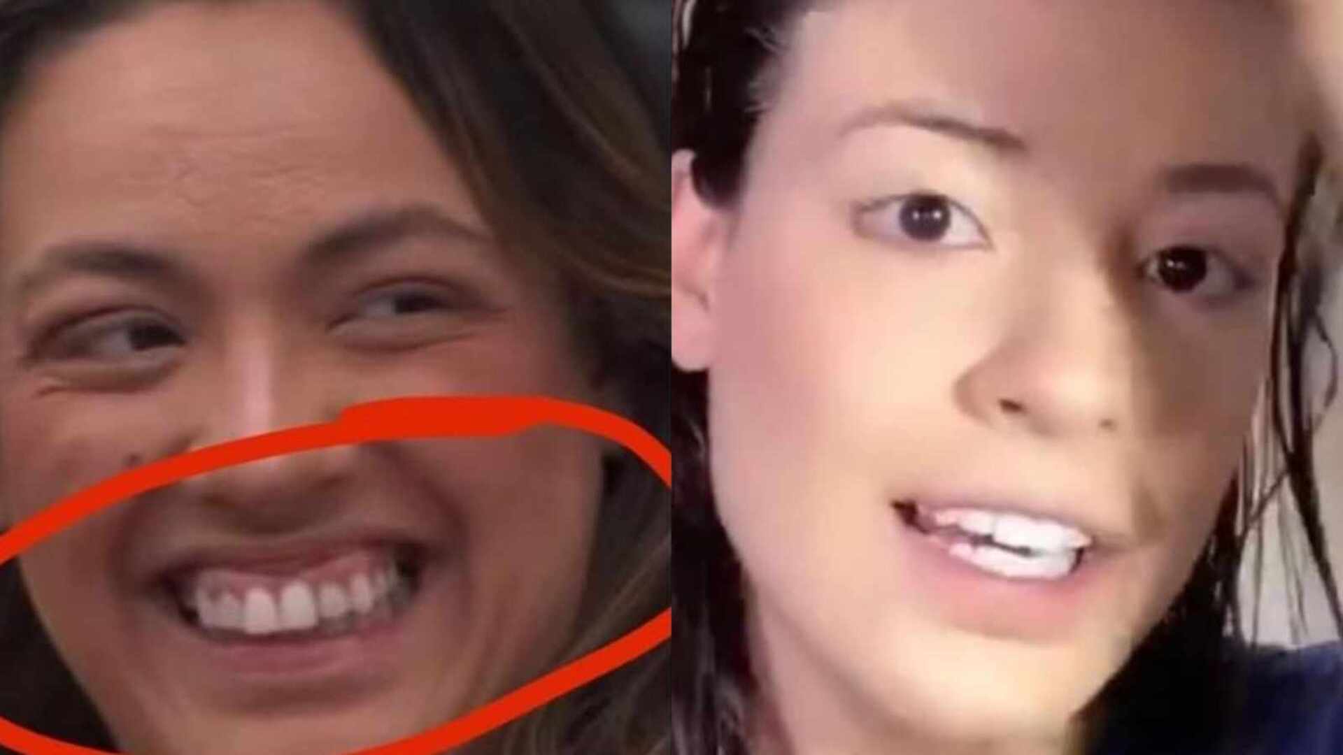 BBB 24: Personagem? Ex-BBB alega que Bia tirou lentes dos dentes