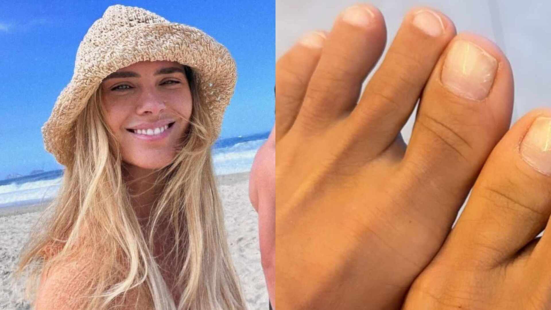 Carolina Dieckmann esclarece sobre ter seis dedos no pé: ‘Parece mesmo’
