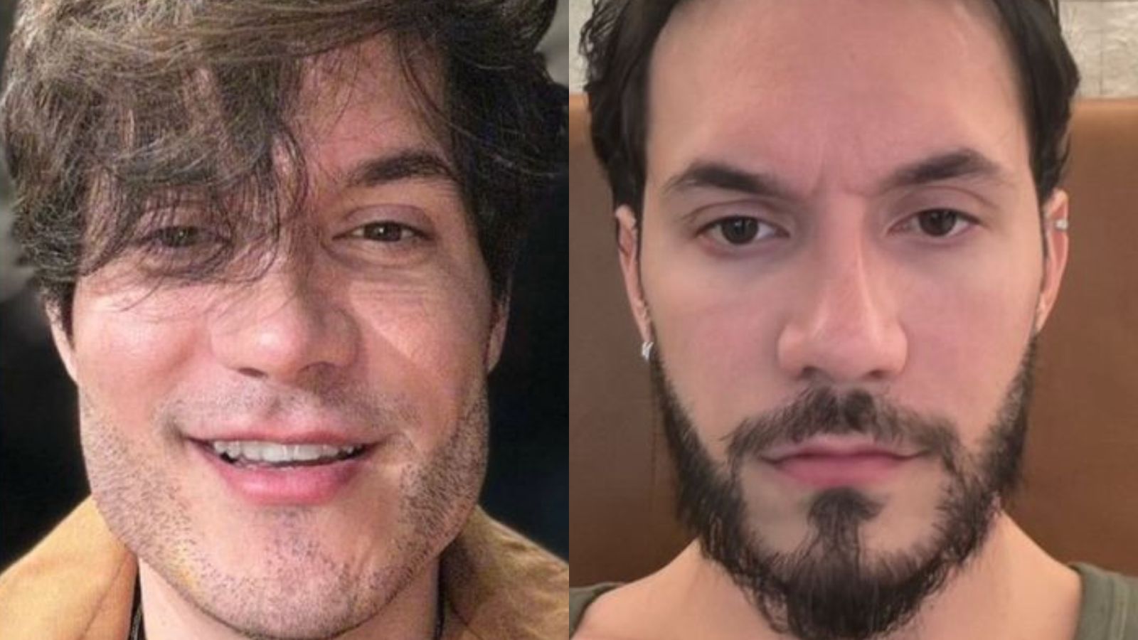 Eliezer desfaz harmonização facial e especialista alerta: ‘Pode deixar sequelas físicas e emocionais’