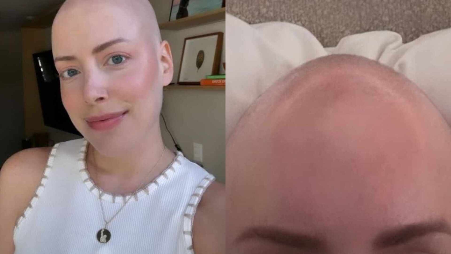 Fabiana Justus revela sensação esquisita com sua careca: ‘Muito doido’