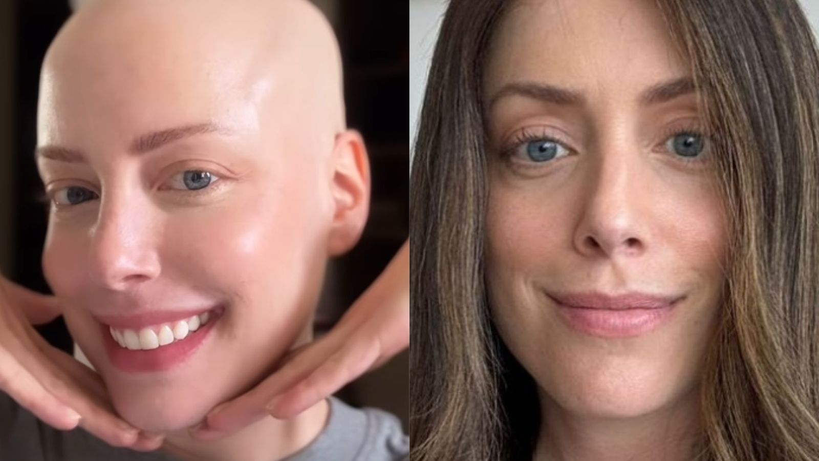 Por que Fabiana Justus decidiu não usar perucas e lenços? Ela explica o motivo