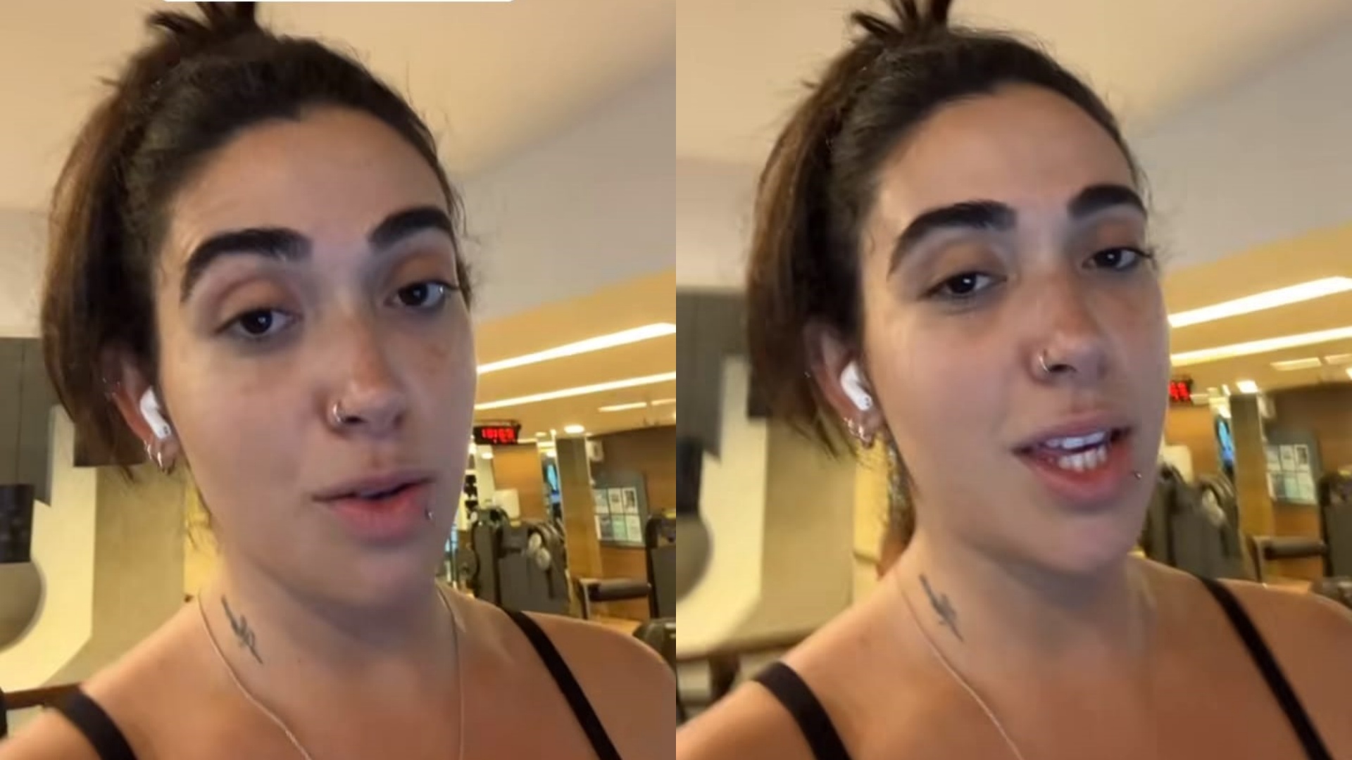 Ex-BBB Giovanna Lima abre o jogo sobre realizar procedimentos estéticos