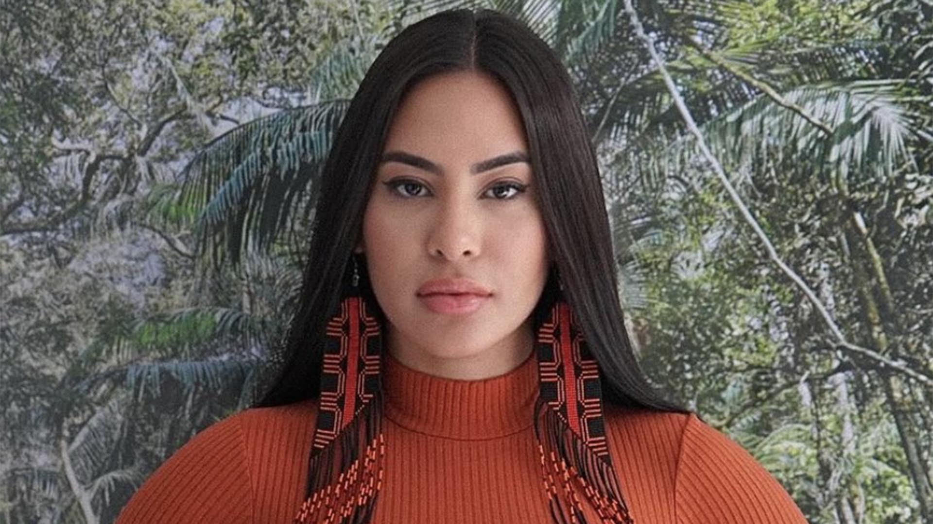 Ex-BBB Isabelle diz que precisa ir ao médico: ‘Não consegue fechar’