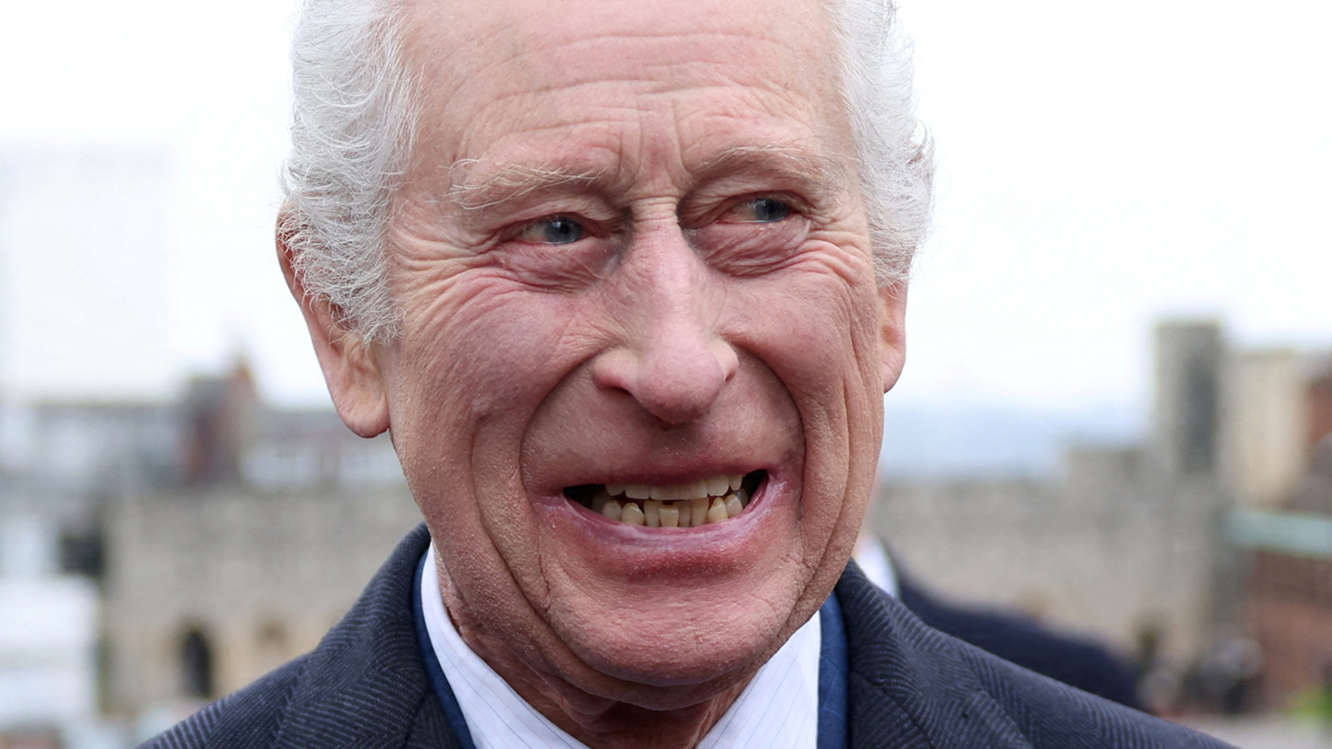 O que aconteceu com os dentes do Rei Charles III? Especialista explica problema de saúde