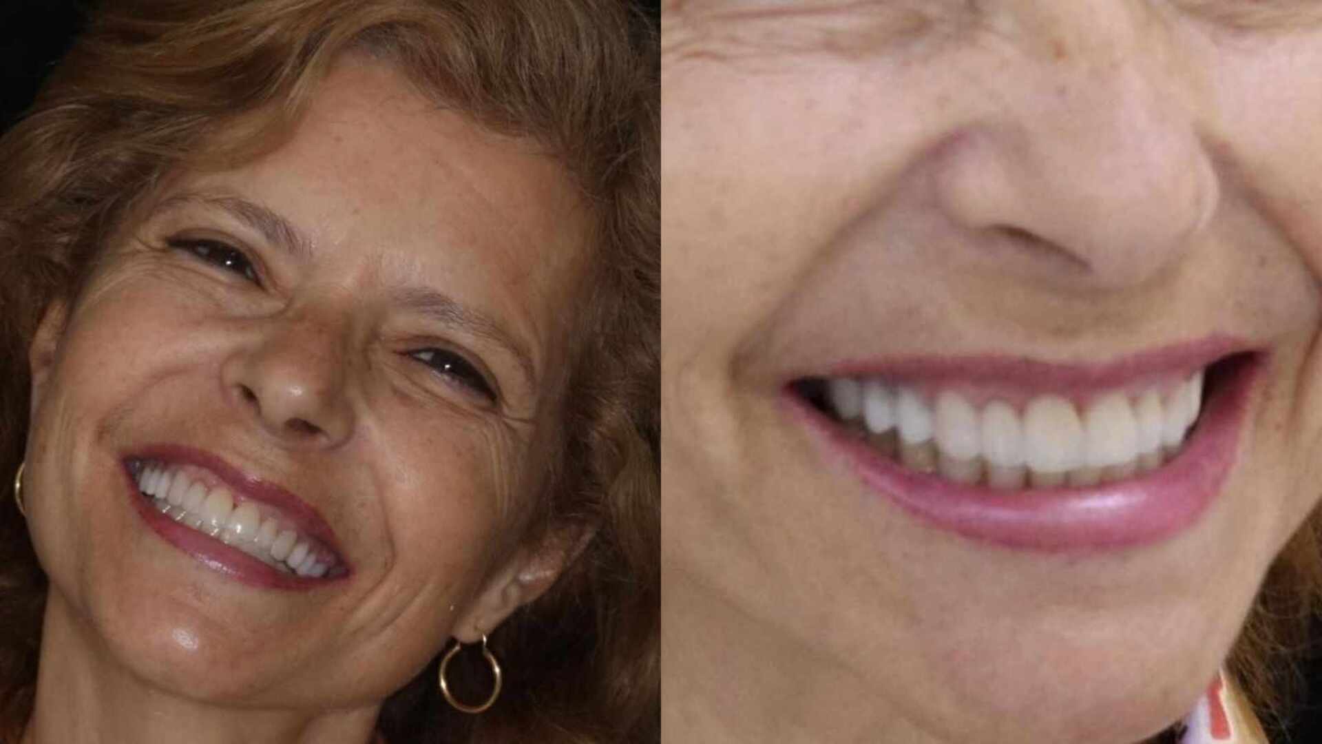 Rose Miriam causa ao mostrar antes e depois de seus dentes: ‘Mais jovem’