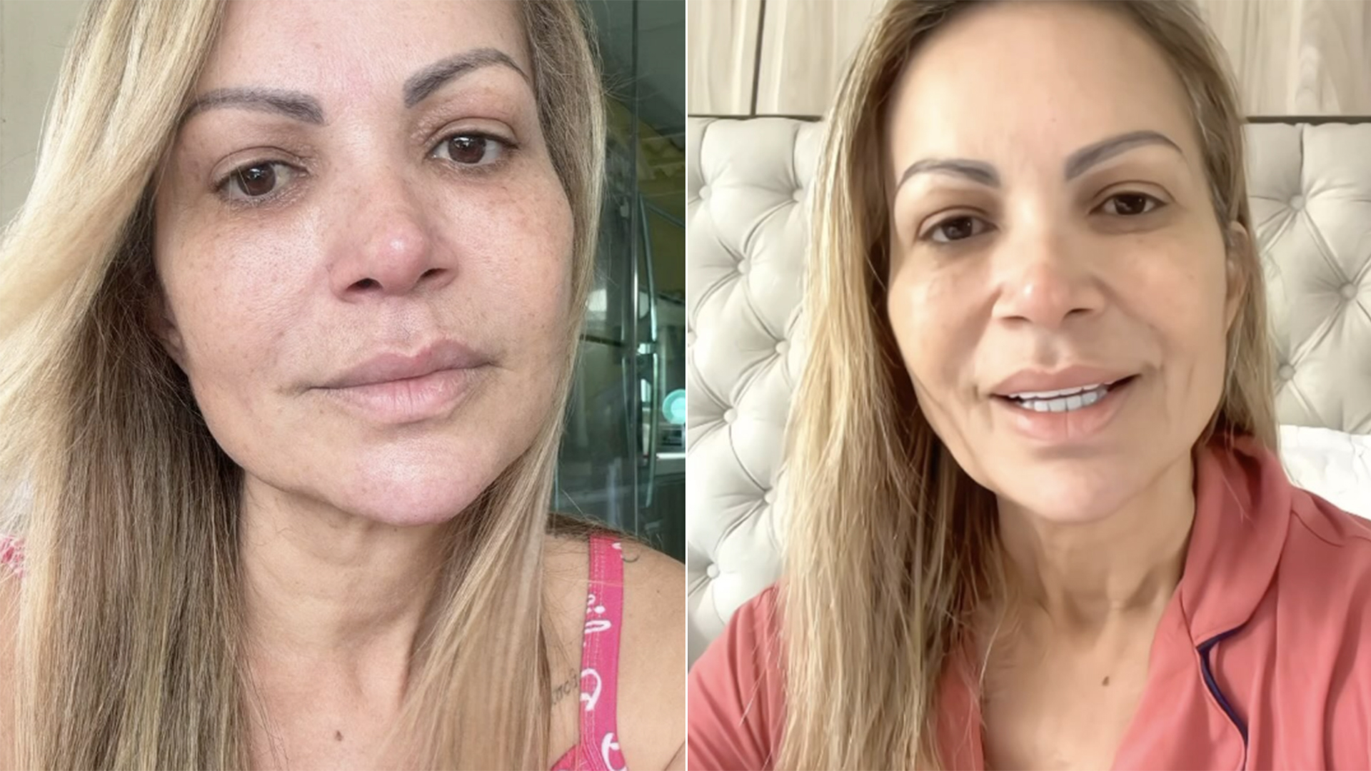 Motivo da cirurgia de Solange Almeida é revelado. Saiba o que aconteceu