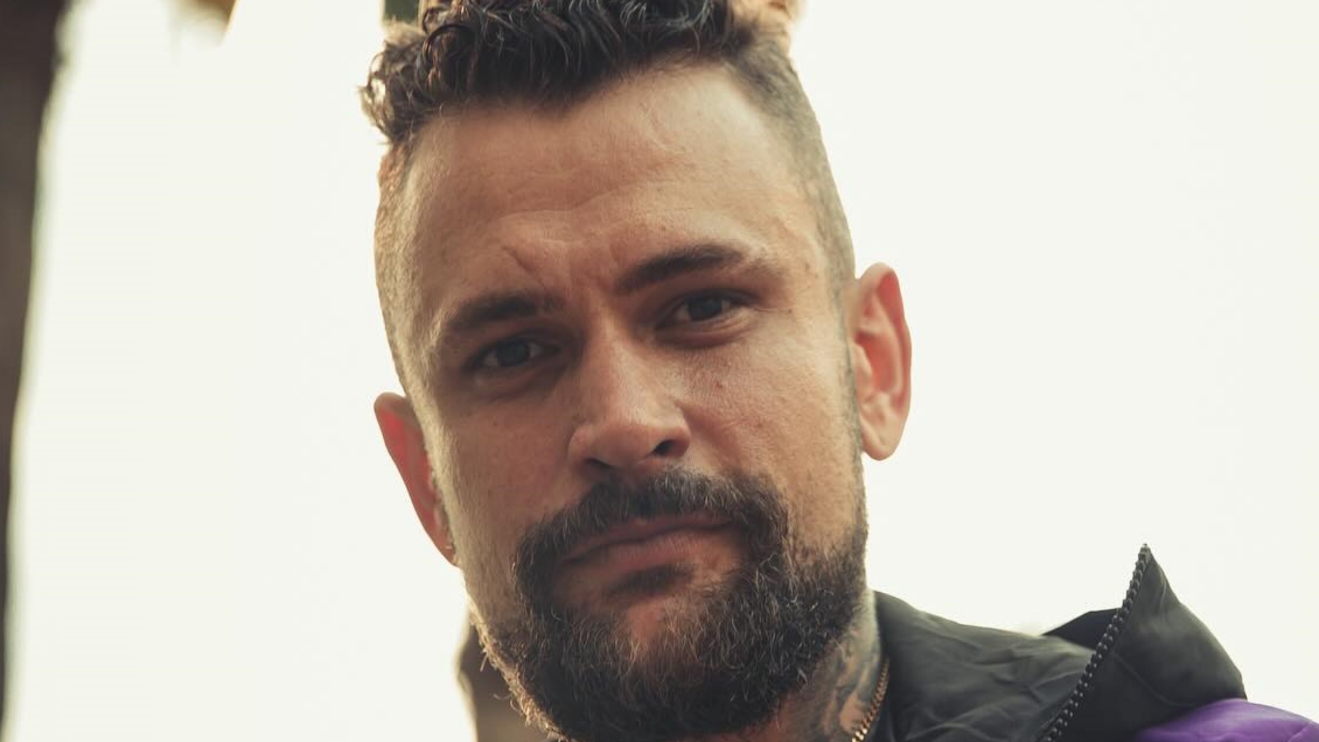 Ex-BBB 24 Vini Rodrigues exibe resultado de harmonização facial; confira!