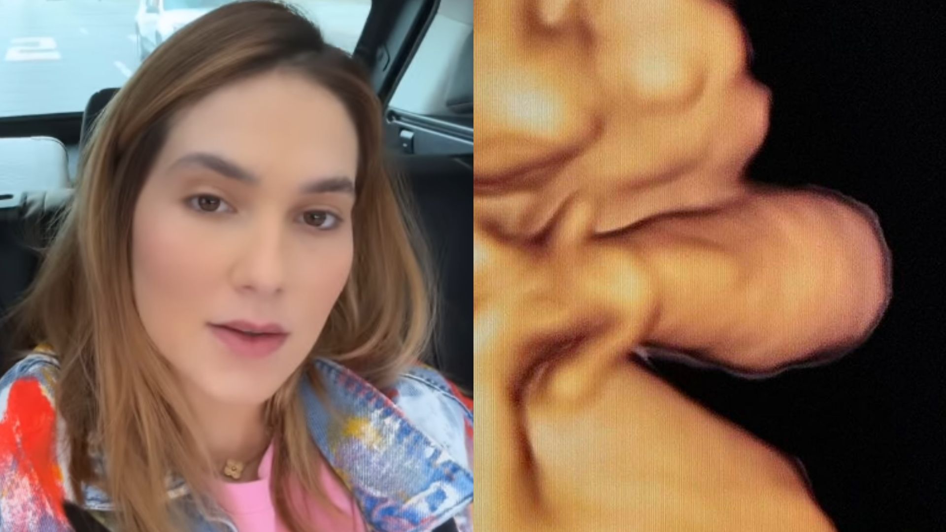 Após tombo no SBT, Virginia Fonseca mostra rostinho do filho em ultrassom