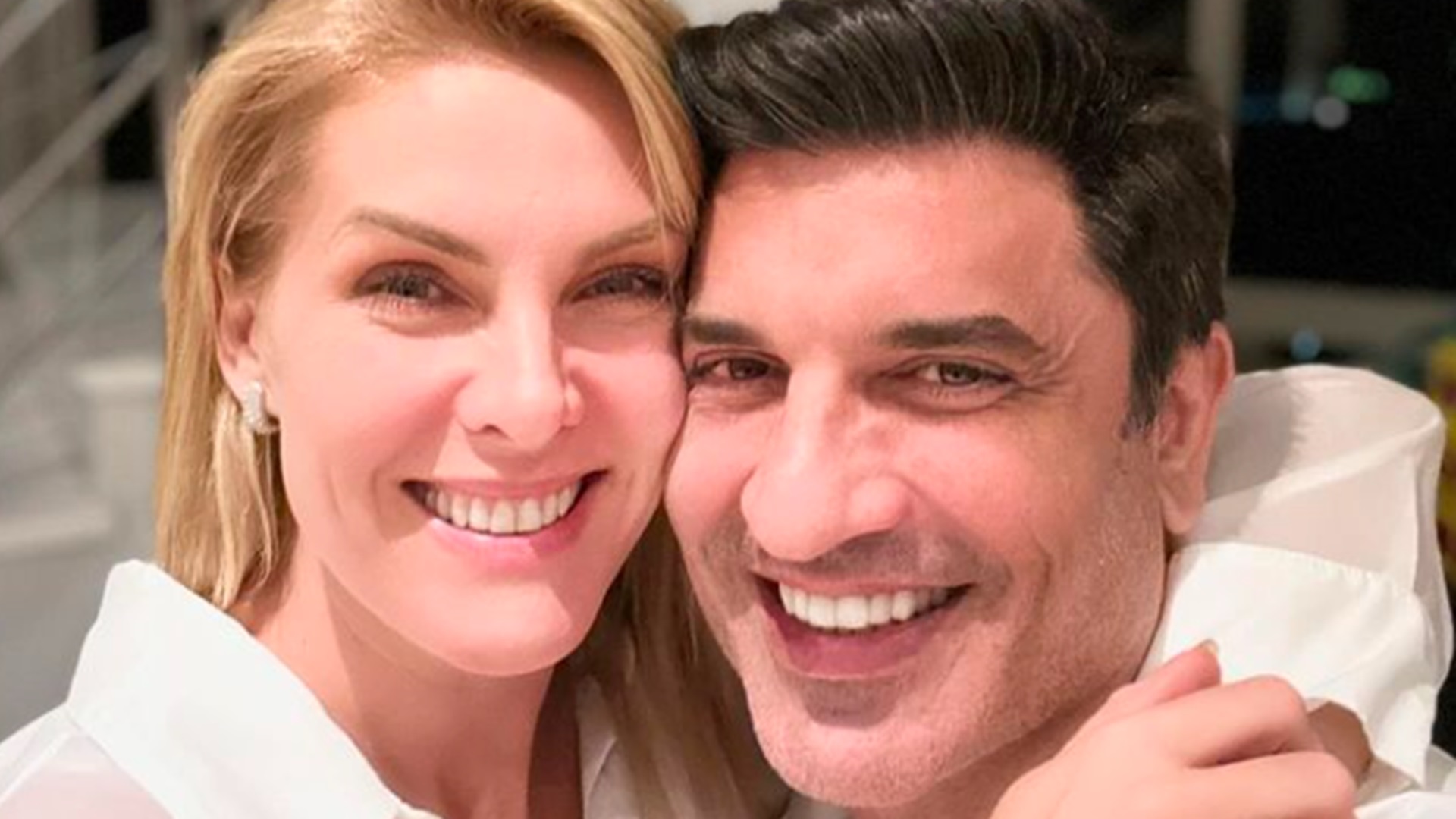 Edu Guedes responde a desabafo de Ana Hickmann sobre sua aparência