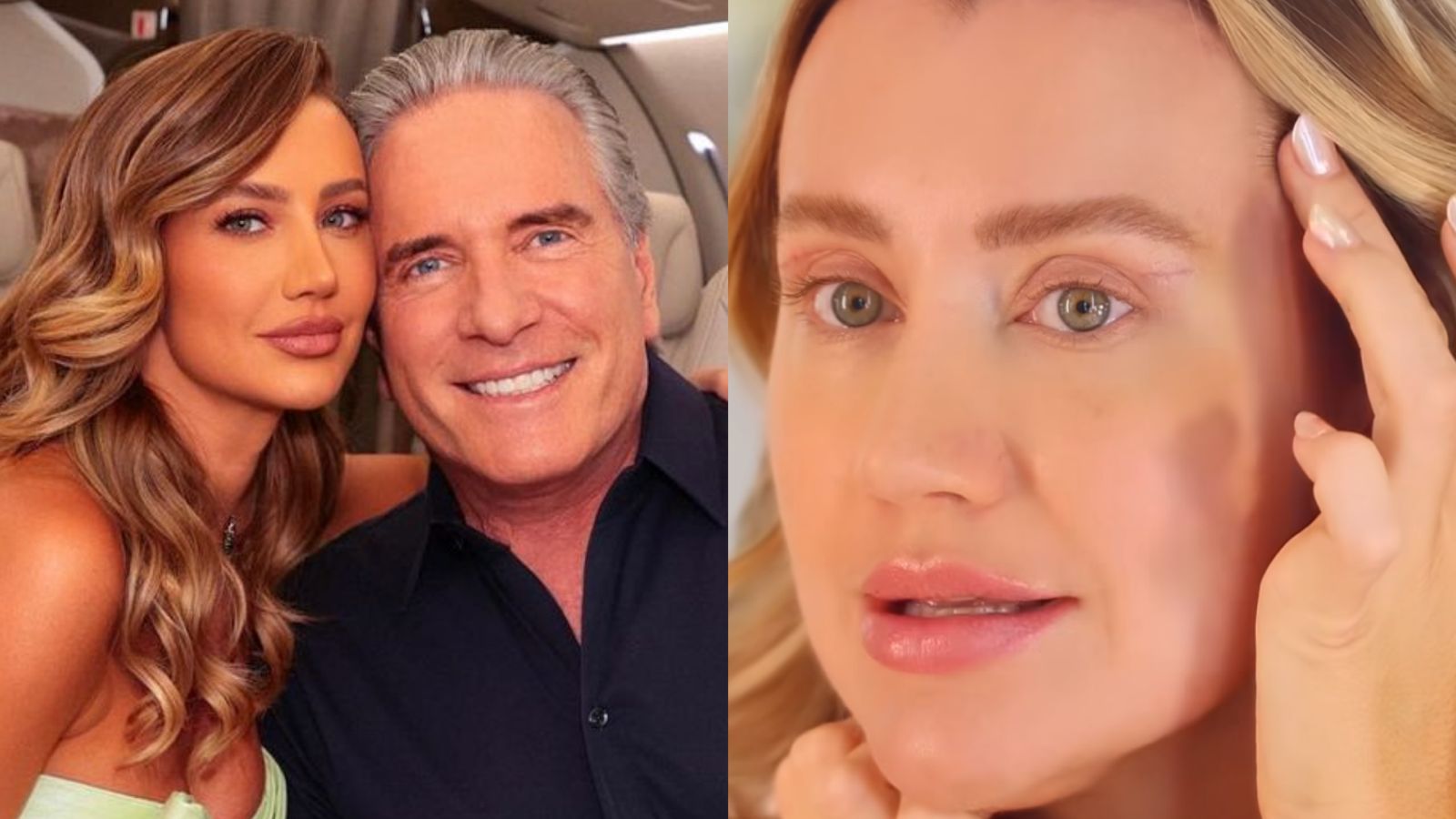 O que Ana Paula Siebert fez no rosto? Esposa de Justus exibe resultado de cirurgia