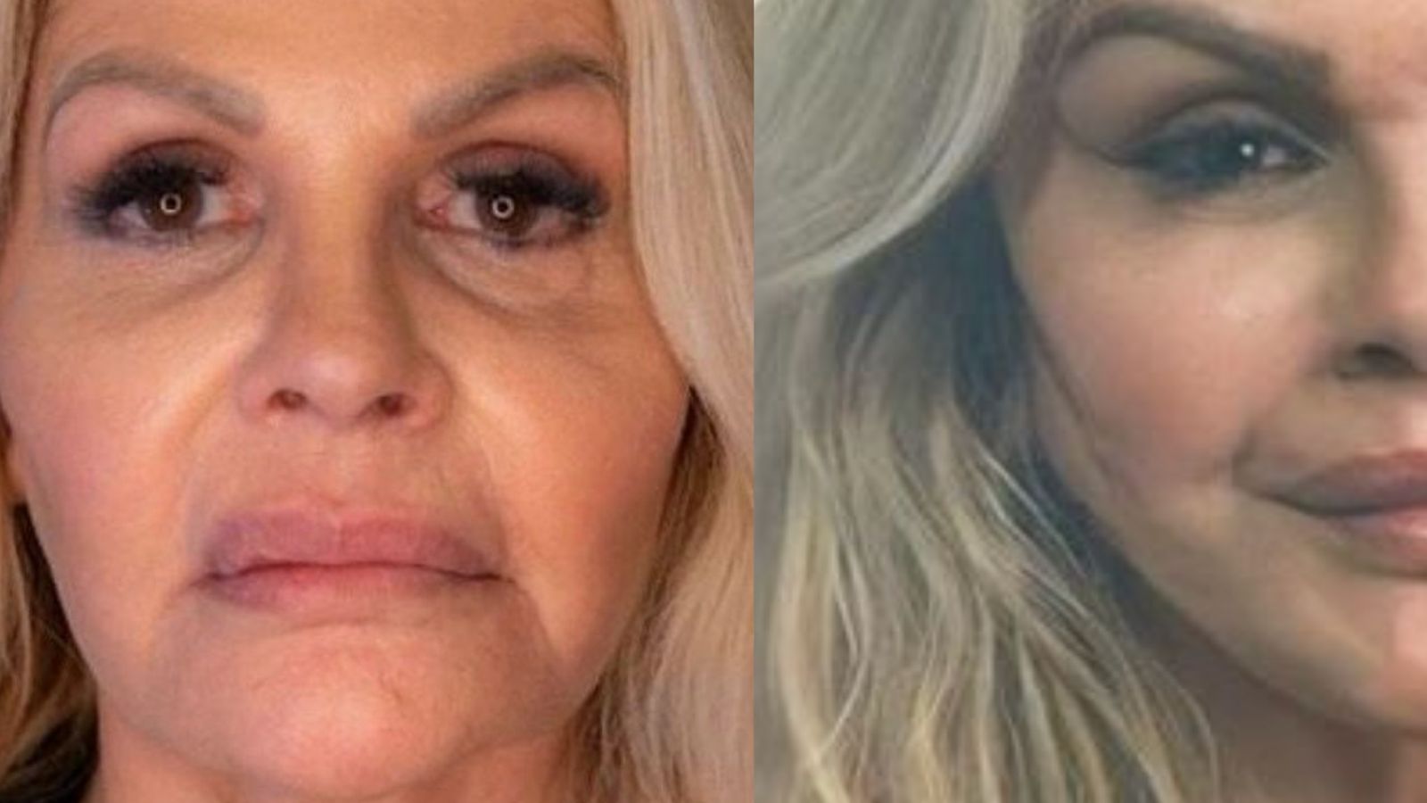 Monique Evans retoca harmonização facial antes de subir ao altar