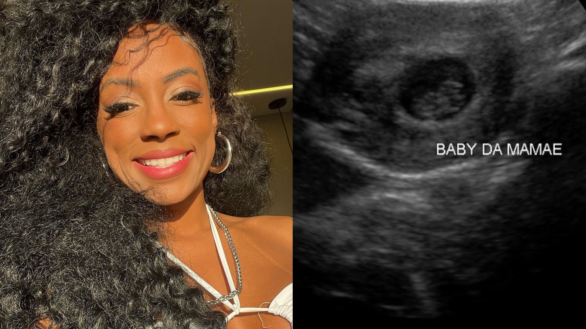 Ex-BBB Lumena revela que sofreu aborto espontâneo: ‘Etapa vivida em silêncio’