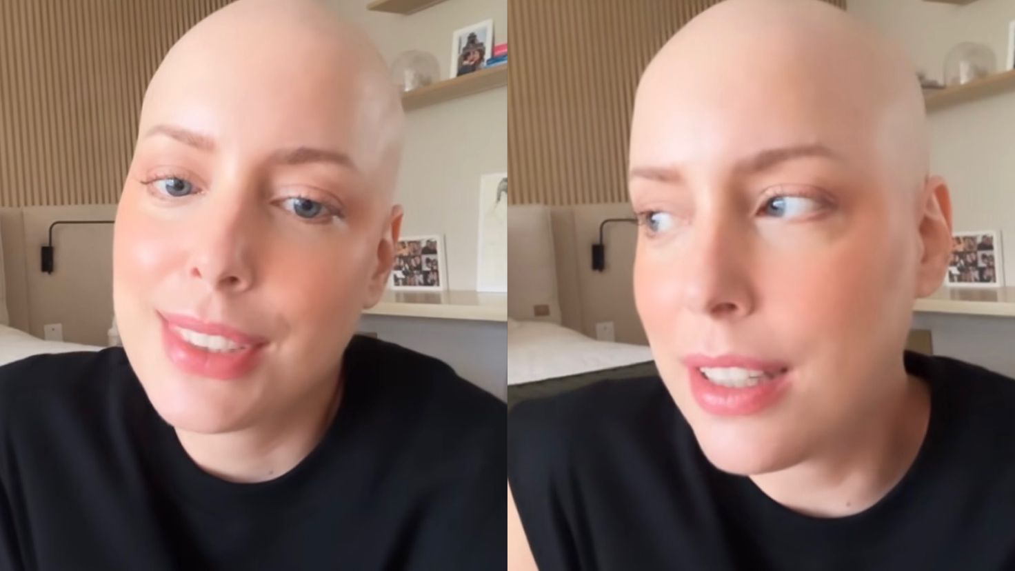 Fabiana Justus fala sobre queda de cílios após tratamento contra câncer