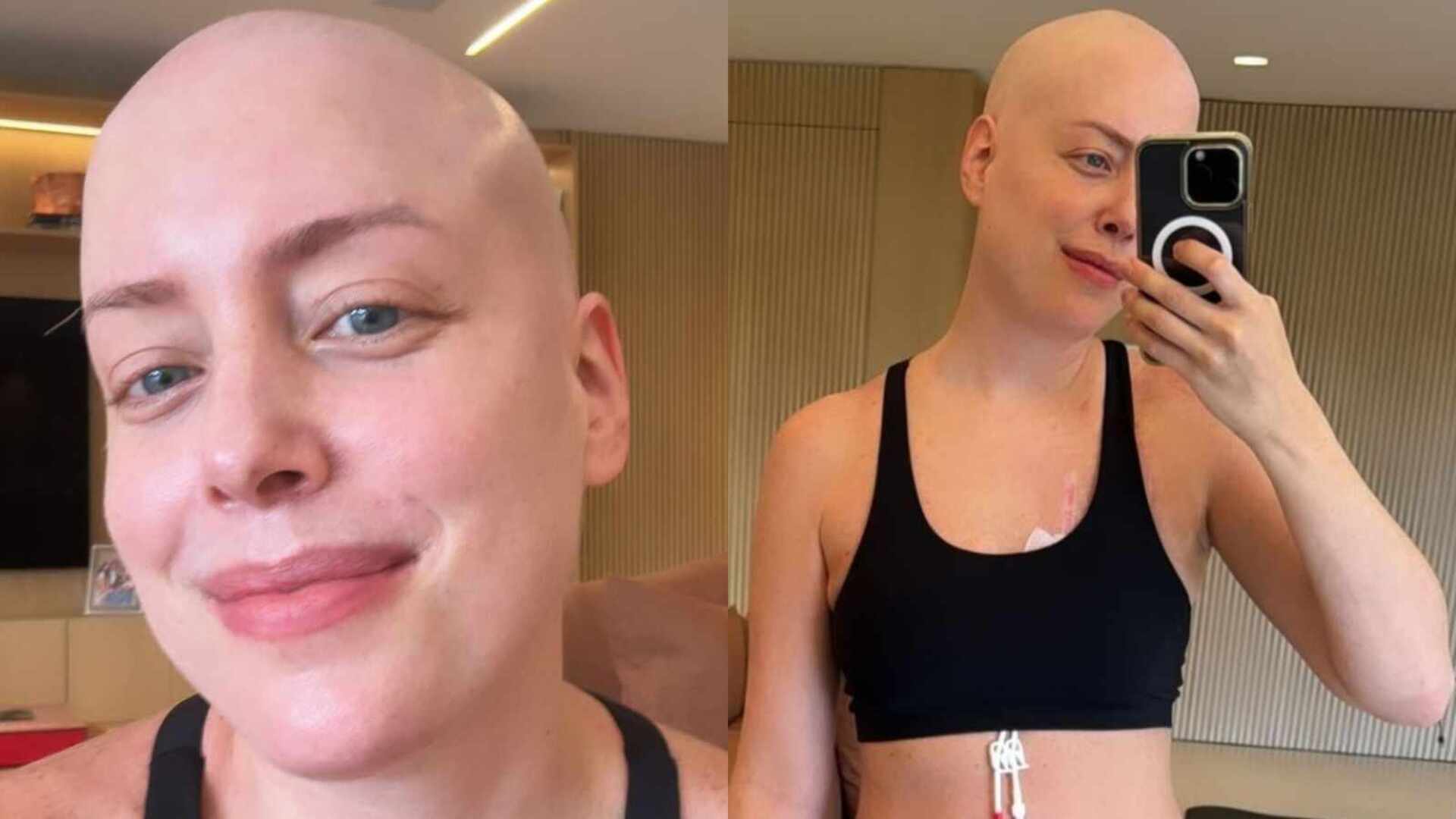 Após 50 dias de transplante, Fabiana Justus revela mudança: ‘Voltei’