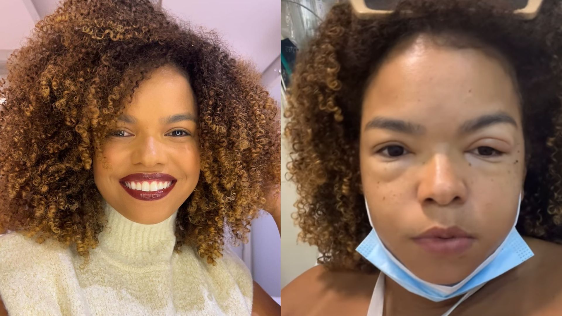Jeniffer Nascimento detalha momento de desespero após crise alérgica