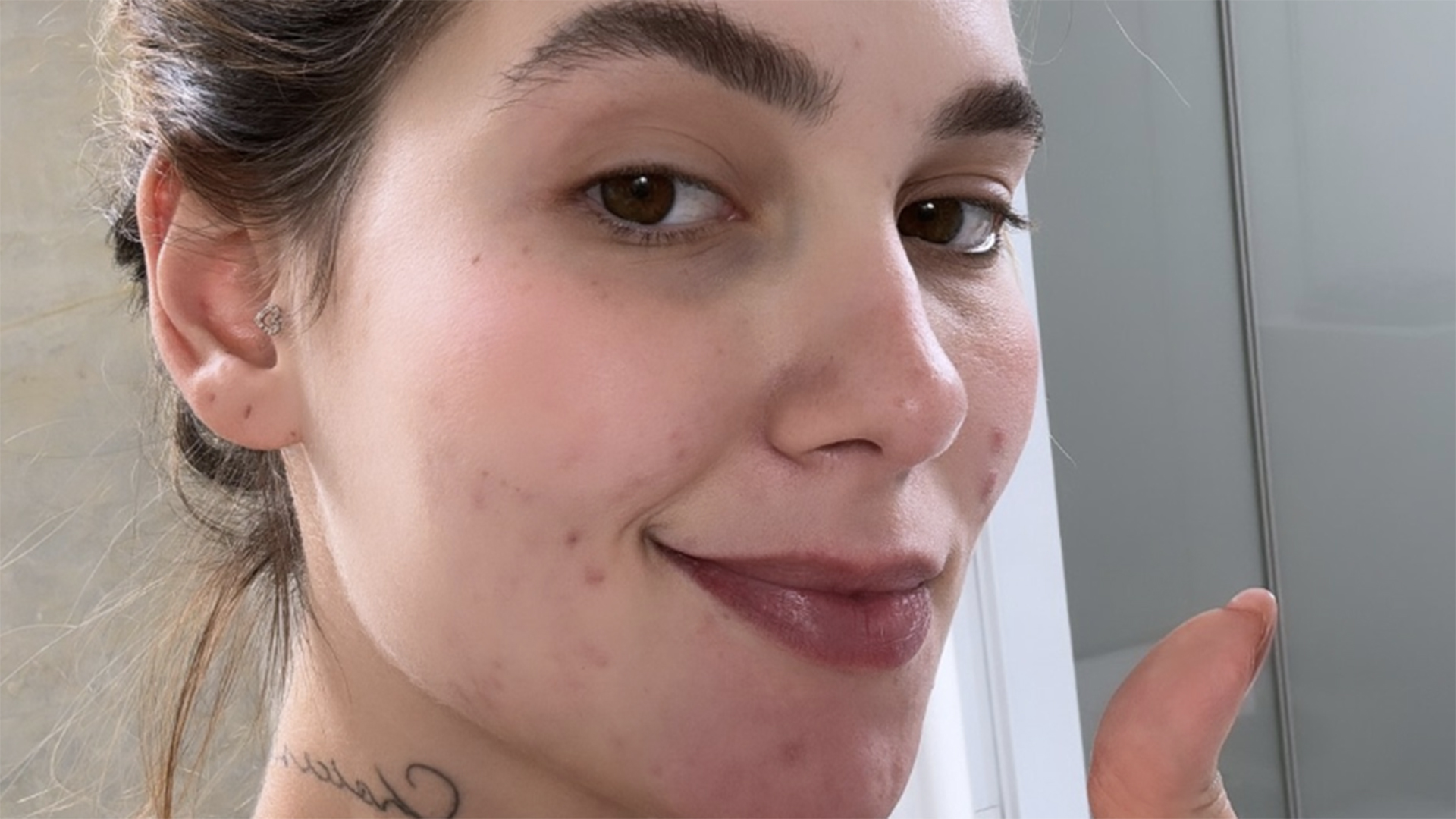 Mãe de Virginia Fonseca surge com hematoma no rosto. Saiba o que aconteceu
