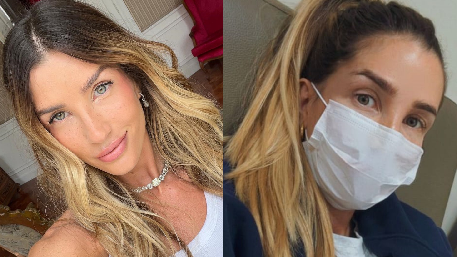 Ex-BBB Aline Gotschalg faz desabafo após internação: “Hoje senti dor”
