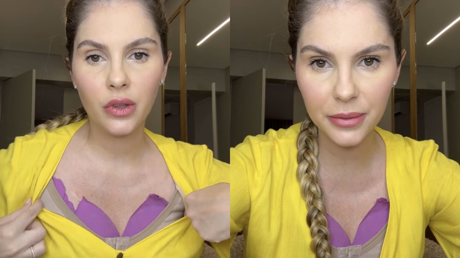 Bárbara Evans mostra resultado de cirurgias plásticas após sete dias: ‘Feliz’