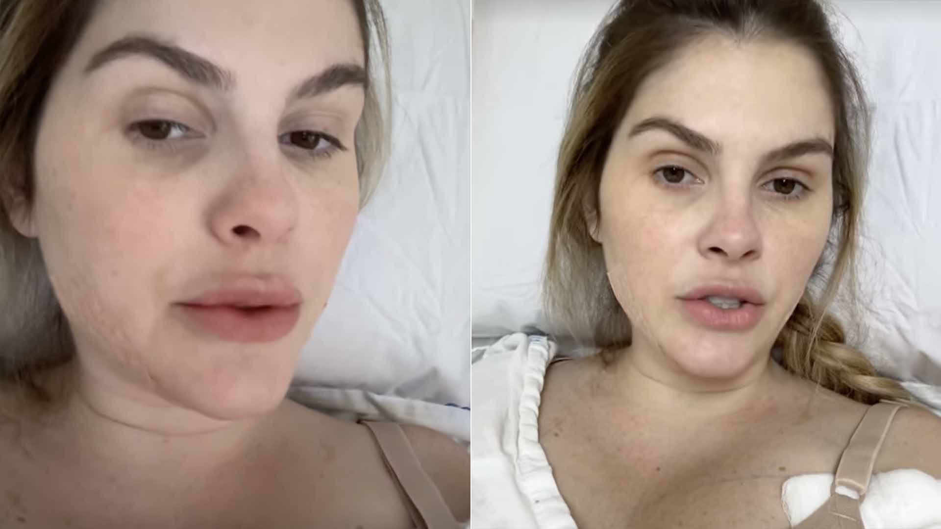 Bárbara Evans passa por cirurgia plástica. Saiba o que ela fez!
