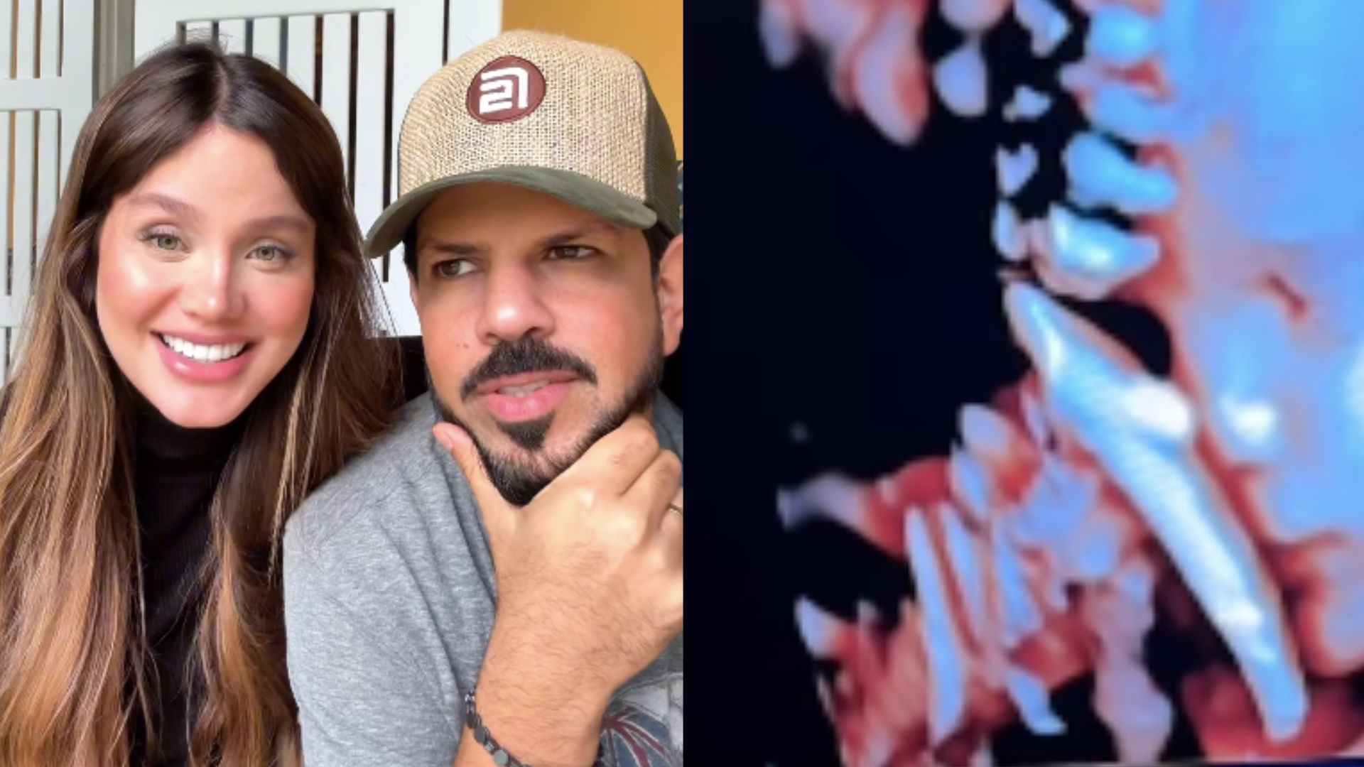 Grávida, Biah Rodrigues mostra rostinho dos gêmeos em novo ultrassom