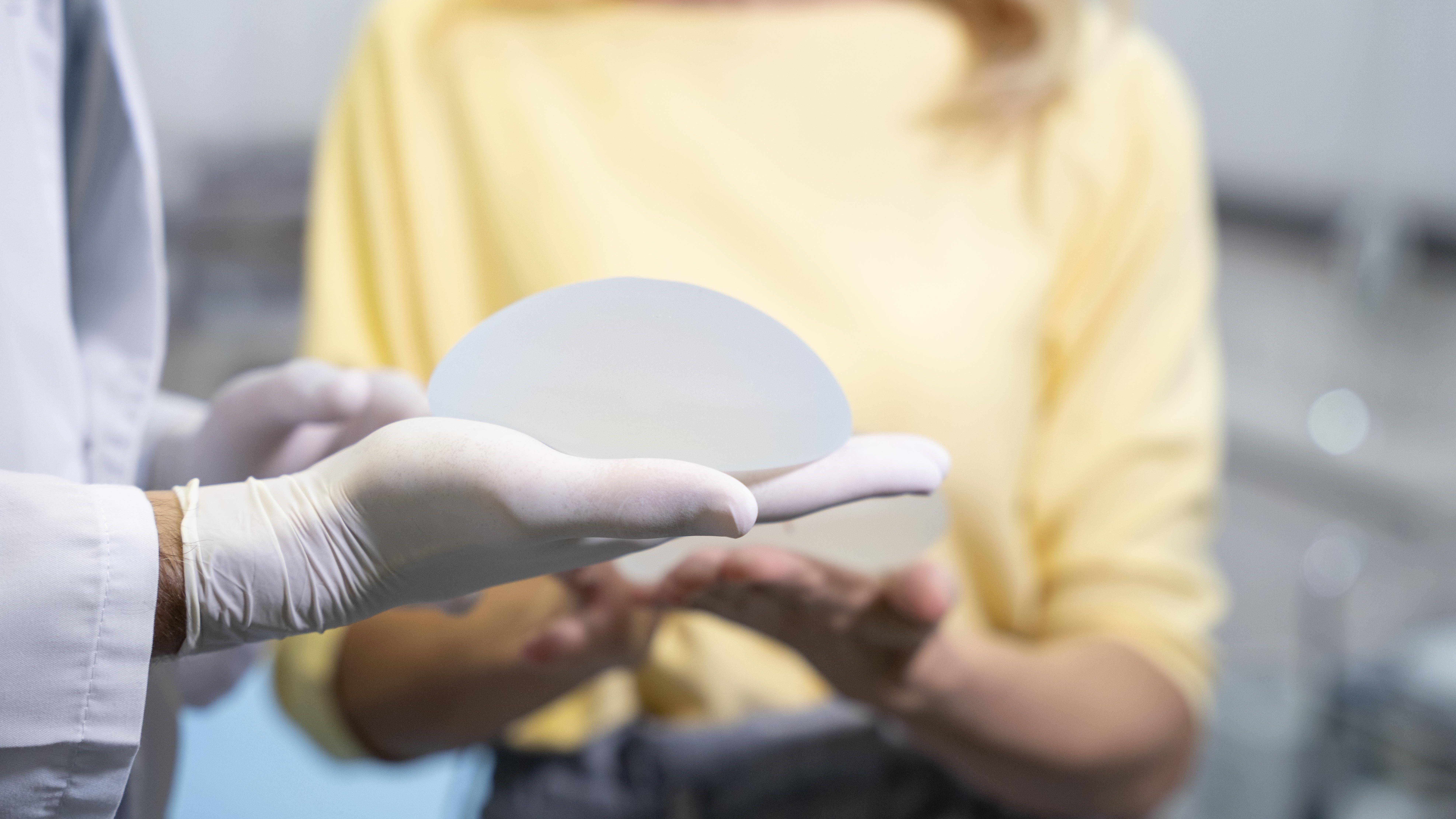 Tendência do explante de silicone tem inúmeros benefícios; saiba quais