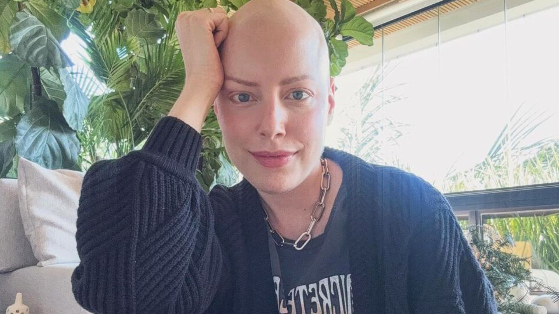 Fabiana Justus revela consequência de tratamento contra o câncer