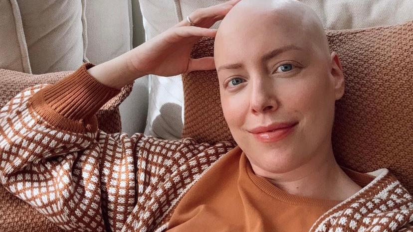 Fabiana Justus fala sobre expectativa para cabelo pós-tratamento contra câncer