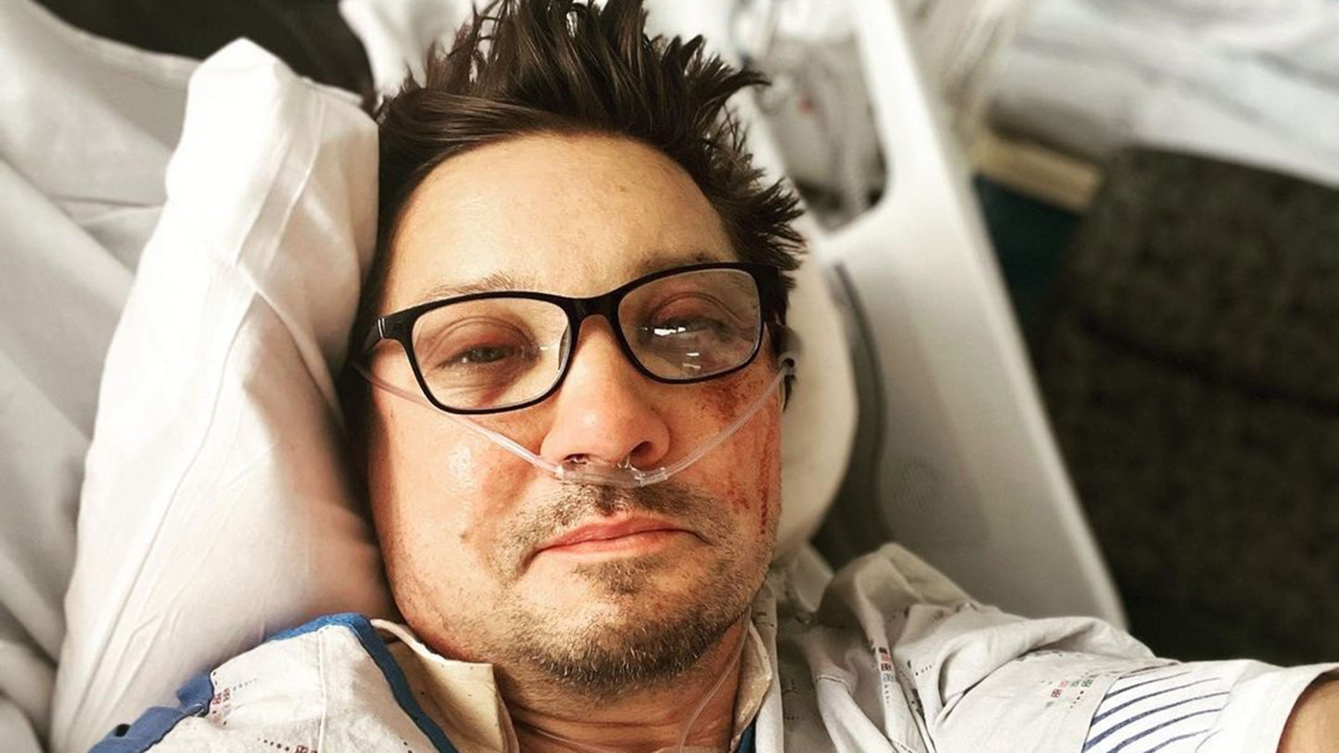 Jeremy Renner dá detalhes fortes sobre acidente: ‘Meu olho ficou saliente’