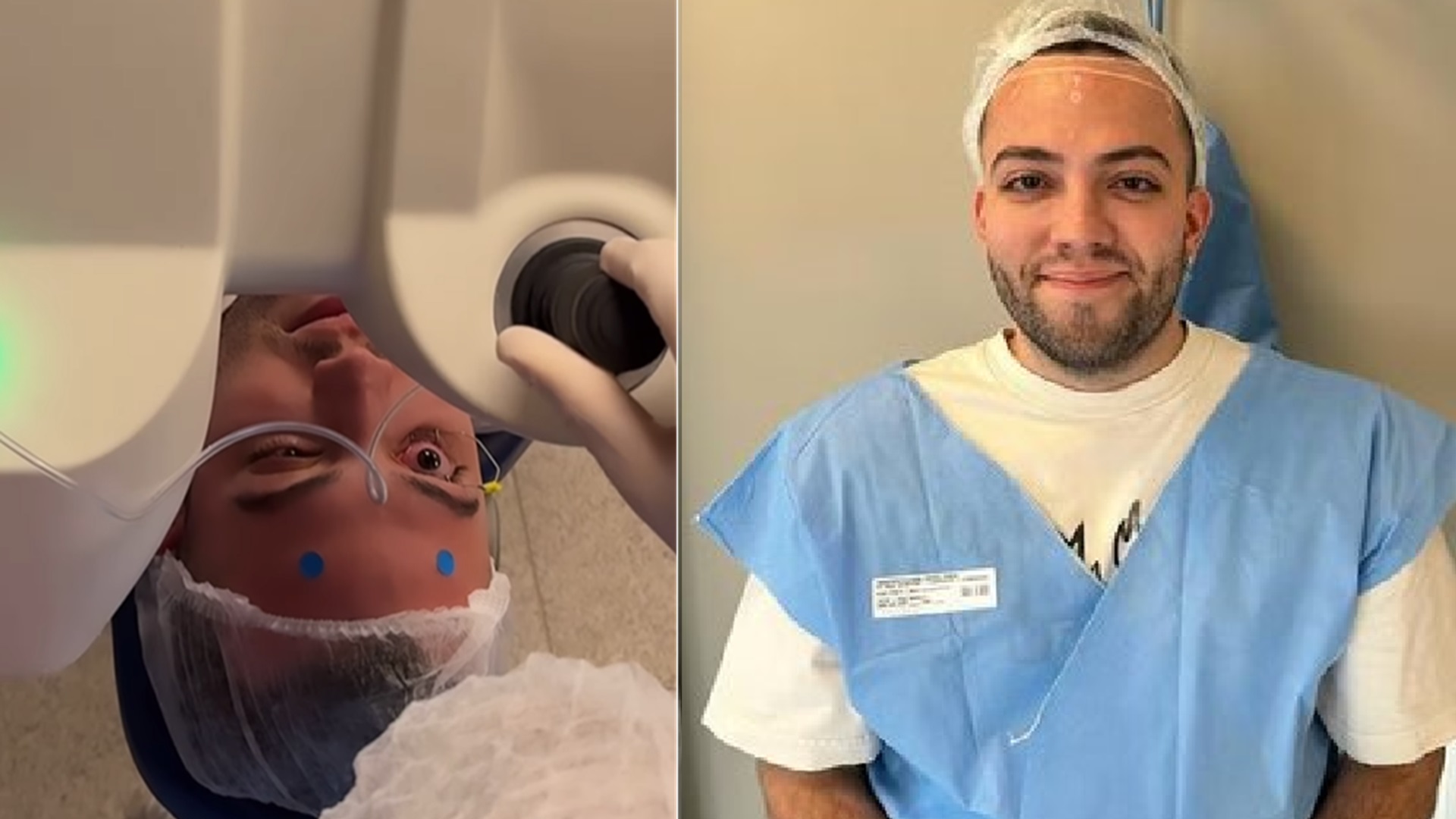 Lucas Rangel fez cirurgia para reduzir testa? Influenciador explica