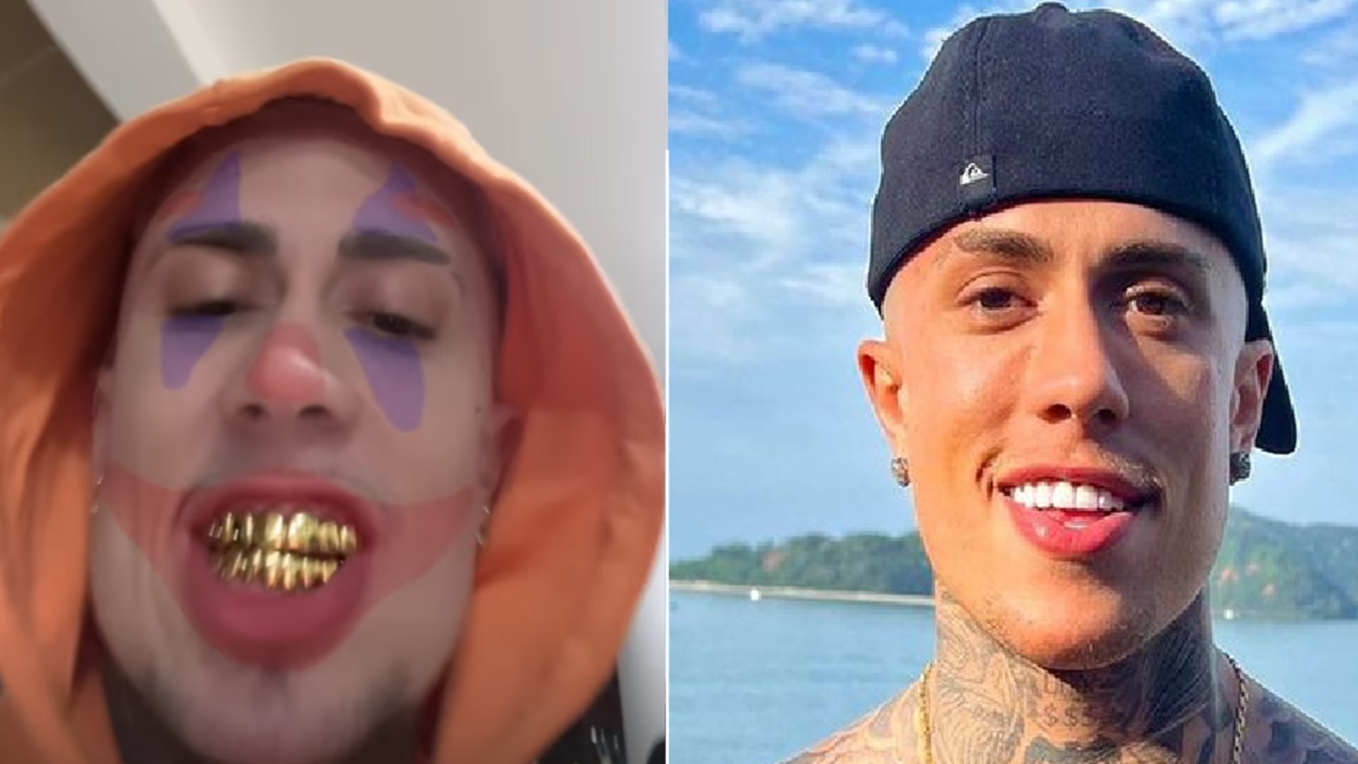 MC Daniel mostra prótese de ouro nos dentes; saiba quanto custa