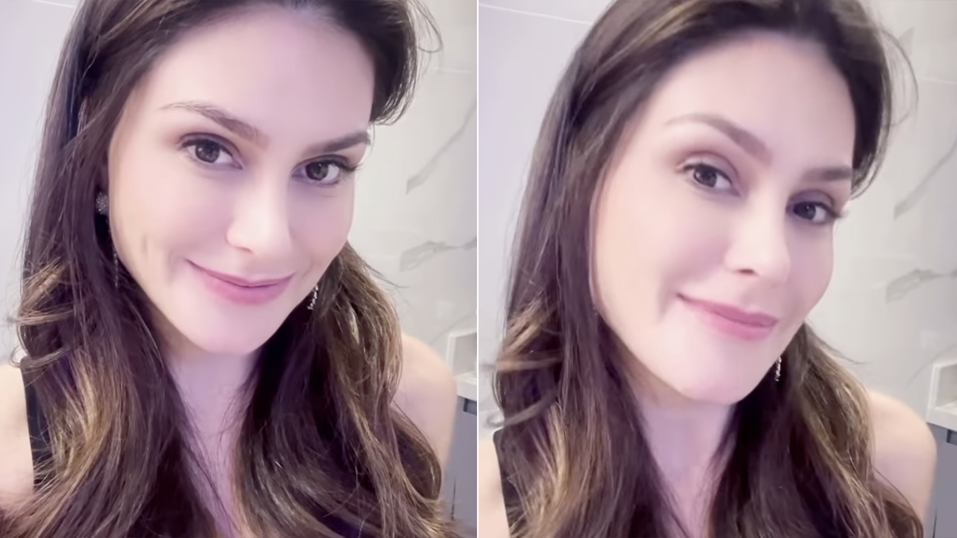 Natália Guimarães sofre queimaduras em acidente doméstico: ‘Grave’