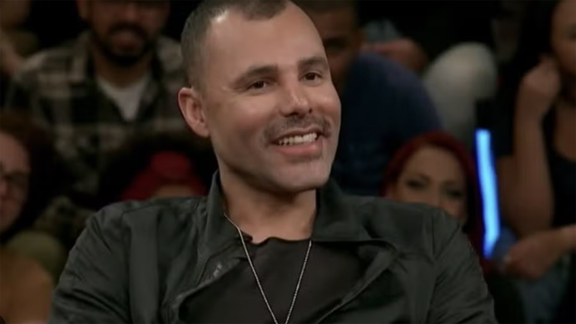 Rodrigo Sant’anna abre o jogo sobre harmonização facial: ‘Quadrada’
