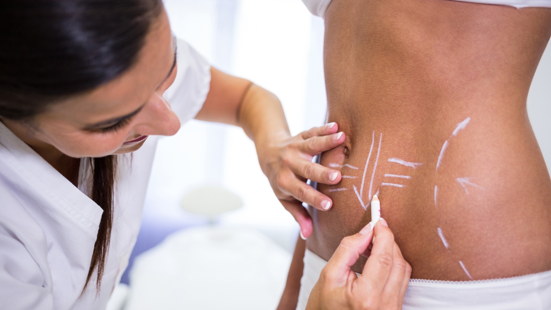 Quer fazer lipo? Médico alerta sobre recuperação delicada no pós-operatório