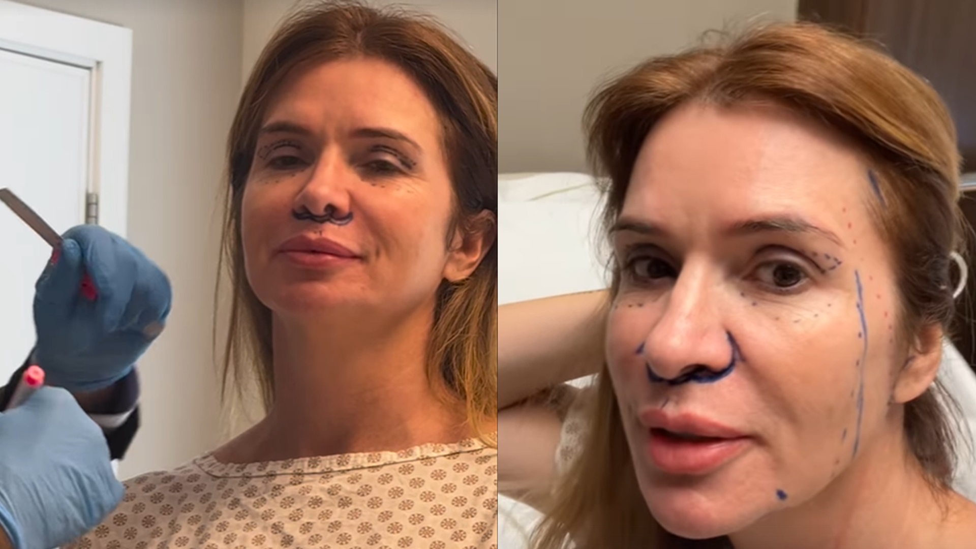 Mãe de Viih Tube mostra resultado de procedimento estético: “Impressionada”