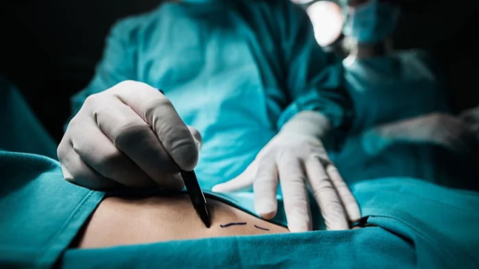 Especialista revela popularidade do Brasil em cirurgias plásticas: ‘Destinos mais procurados’