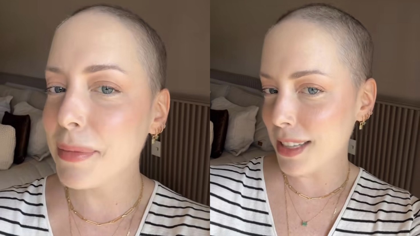 Fabiana Justus mostra crescimento do cabelo após tratamento contra câncer