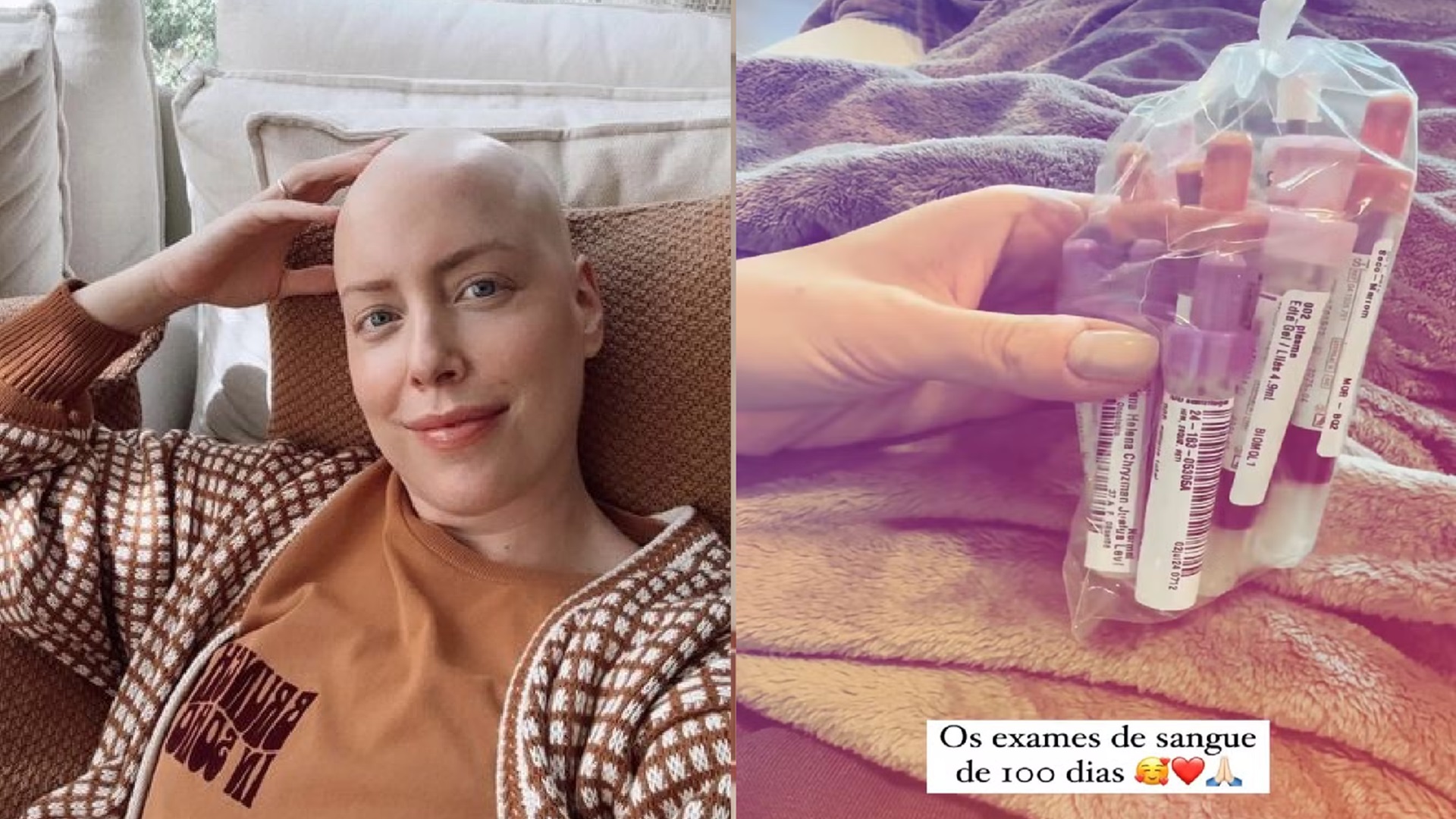 Fabiana Justus comemora 100 dias do transplante e conta novidade: “Alívio”