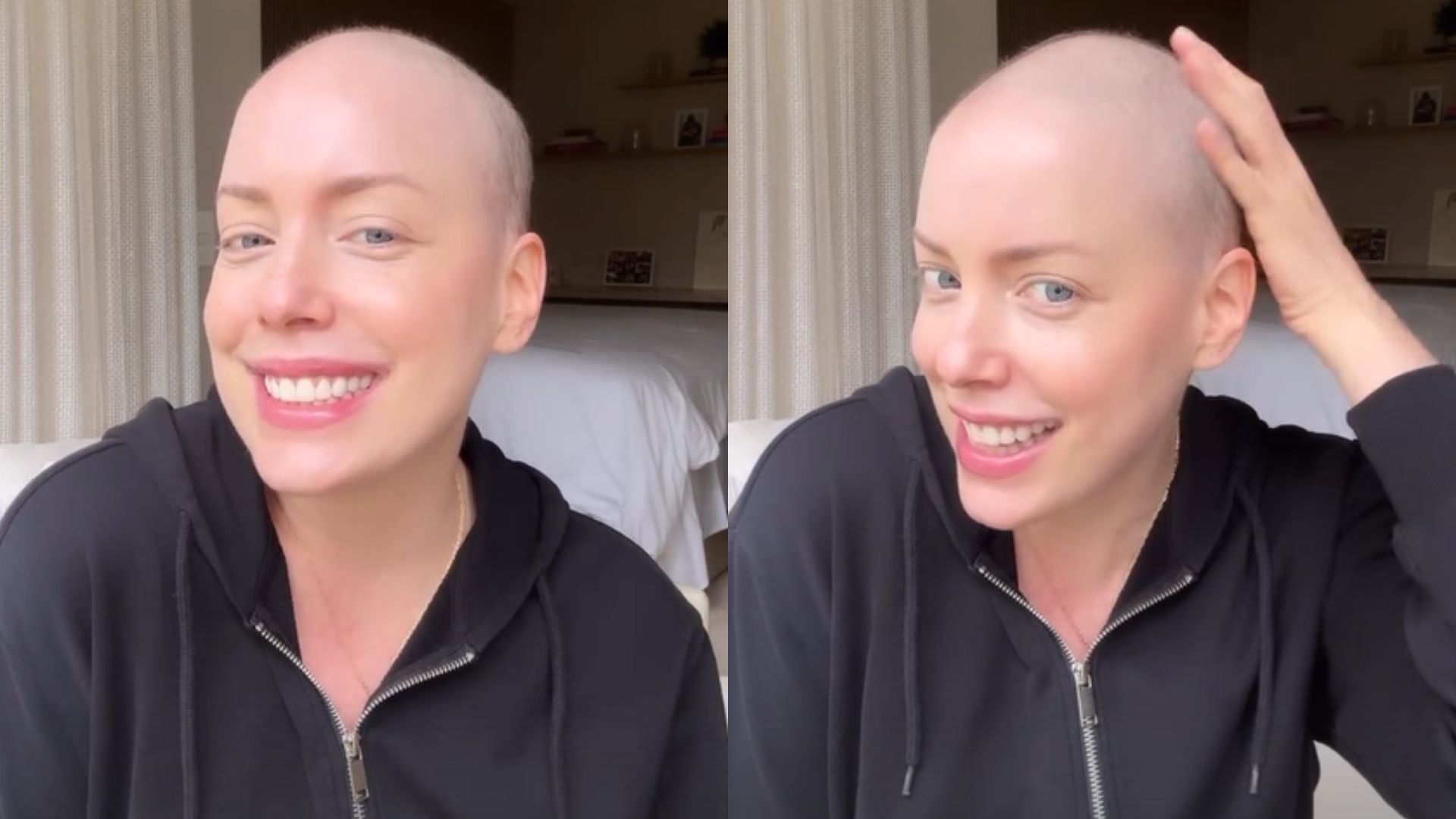 Fabiana Justus agradece elogios após queda de cabelo e reflete sobre autoestima: “Faz a diferença”