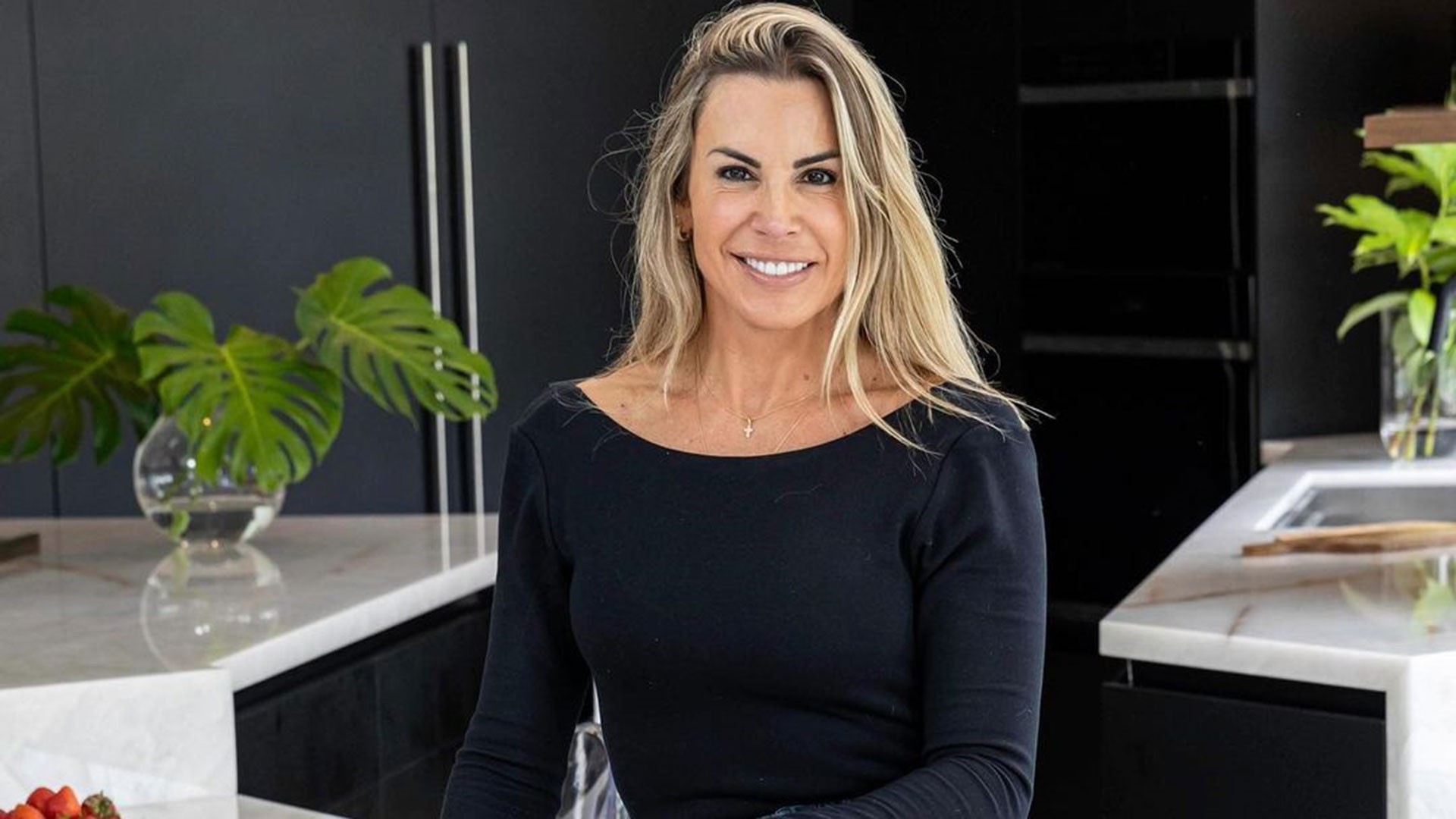 Joana Prado faz harmonização facial e mostra antes e depois. Veja!
