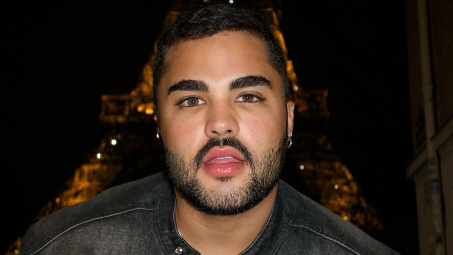 Lucas Guedez choca ao mostrar resultado do transplante capilar: ‘Surreal’