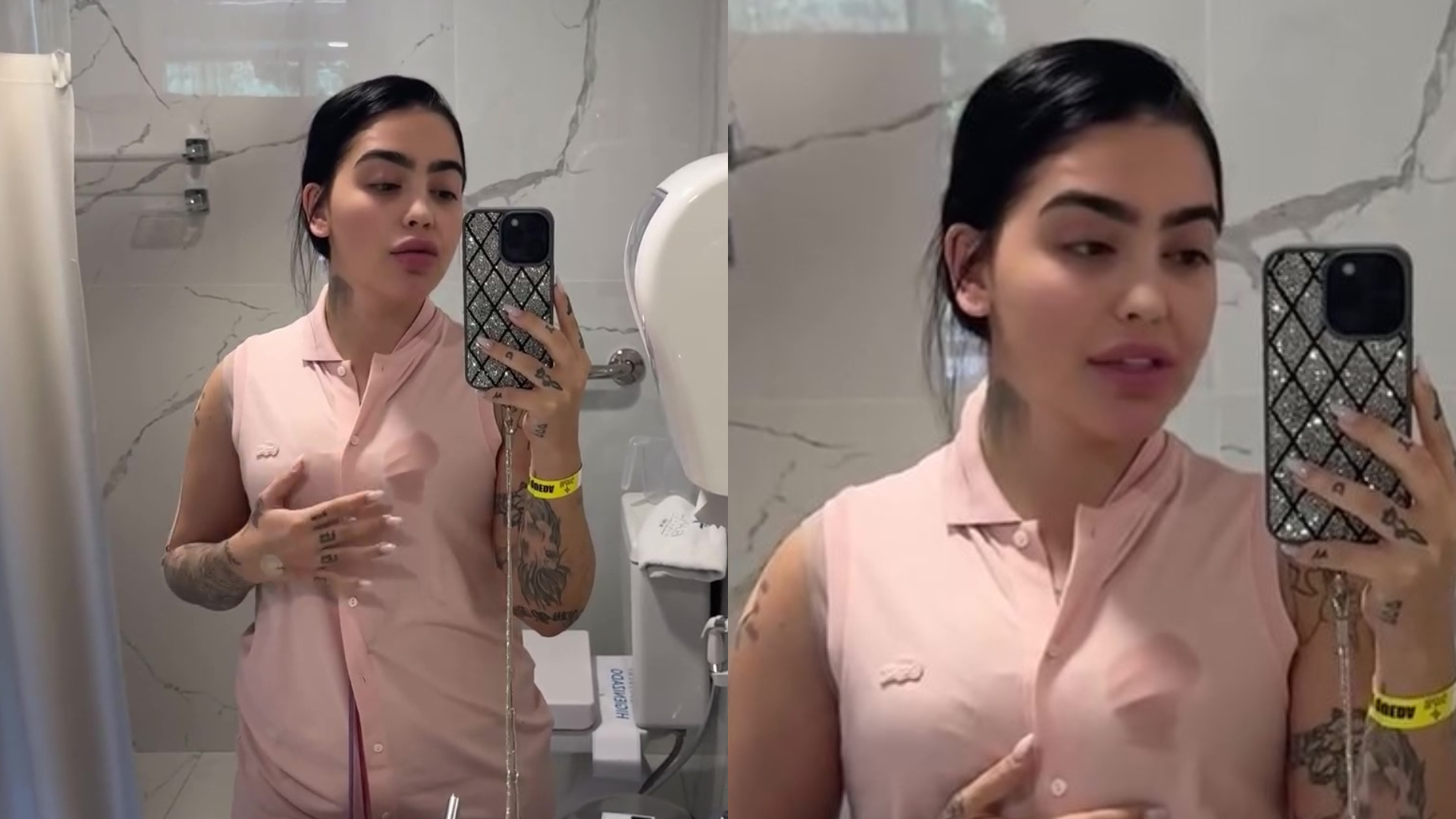 MC Mirella quebra silêncio sobre cirurgia e lista procedimentos realizados