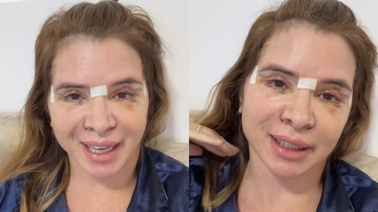 Mãe de Viih Tube fala sobre recuperação depois de passar por cirurgias plásticas