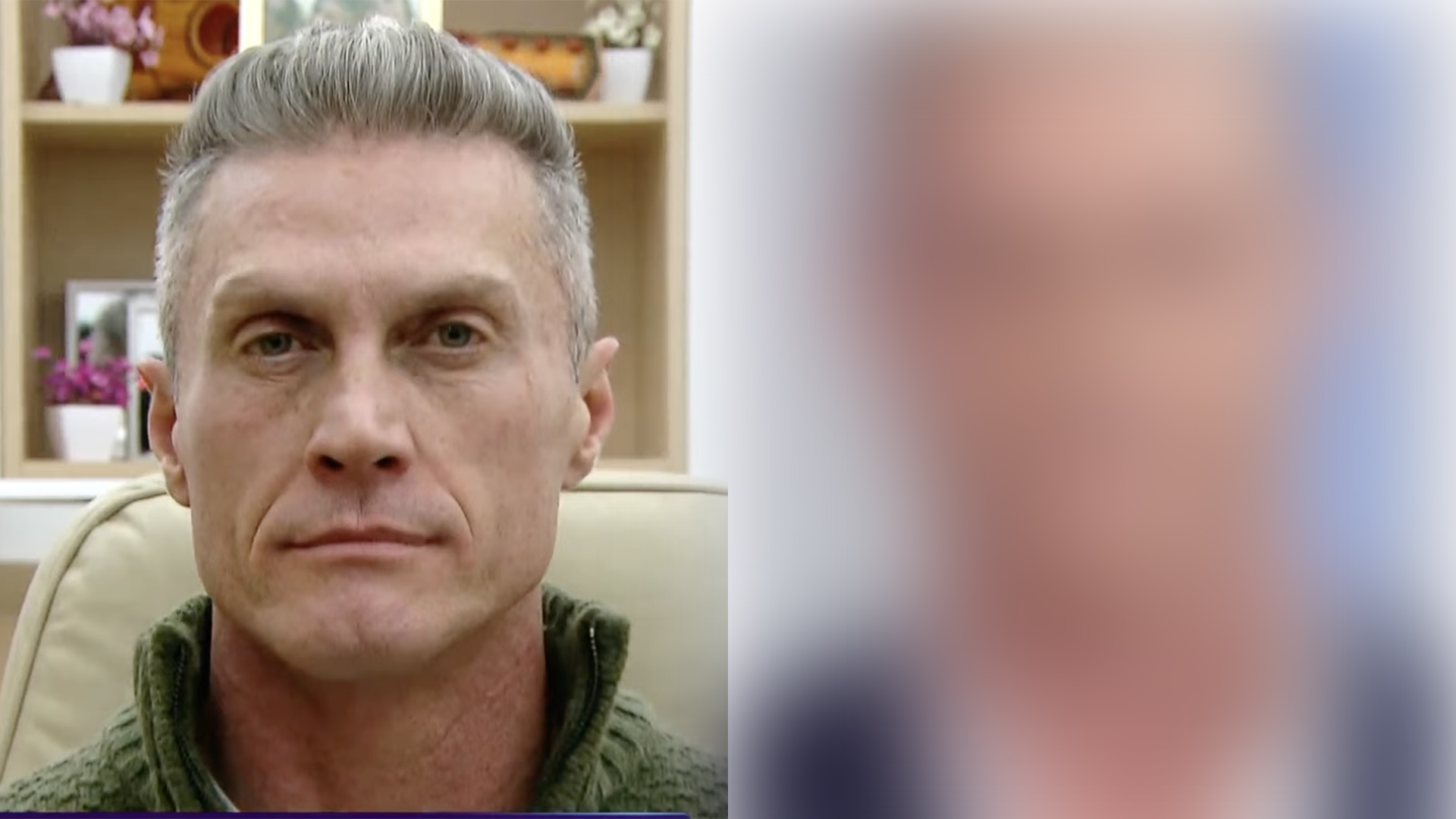 André Segatti faz harmonização facial e mostra o resultado na TV