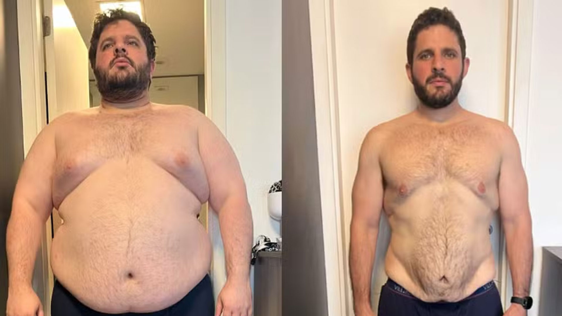Ex-Masterchef choca ao mostrar antes e depois de perder 80kg